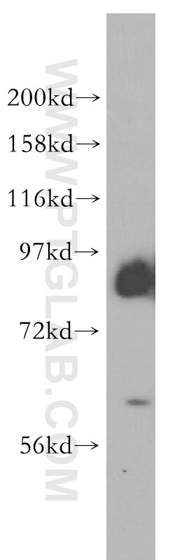 Western Blot (WB) analysis of HeLa cells using PCDHA2 Polyclonal antibody (10127-2-AP)