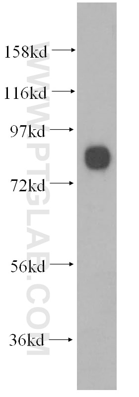 Western Blot (WB) analysis of human brain tissue using PCDHA2 Polyclonal antibody (10127-2-AP)