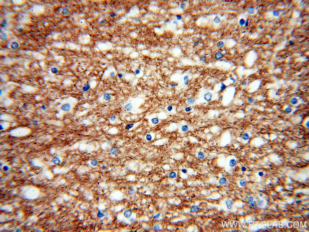 Immunohistochemistry (IHC) staining of human brain tissue using PCDHA3 Polyclonal antibody (18803-1-AP)