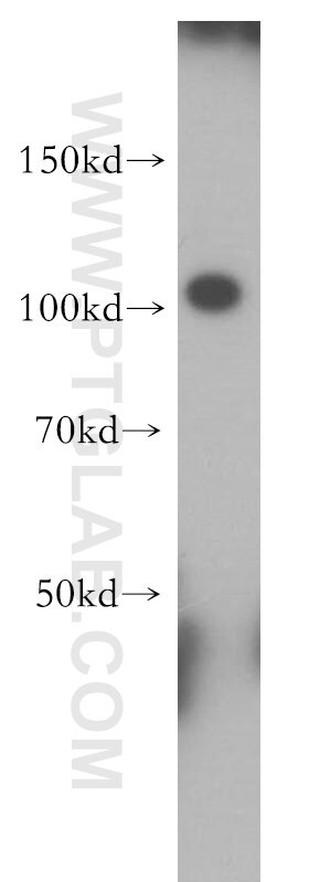 Western Blot (WB) analysis of mouse colon tissue using PCDHA3 Polyclonal antibody (18803-1-AP)