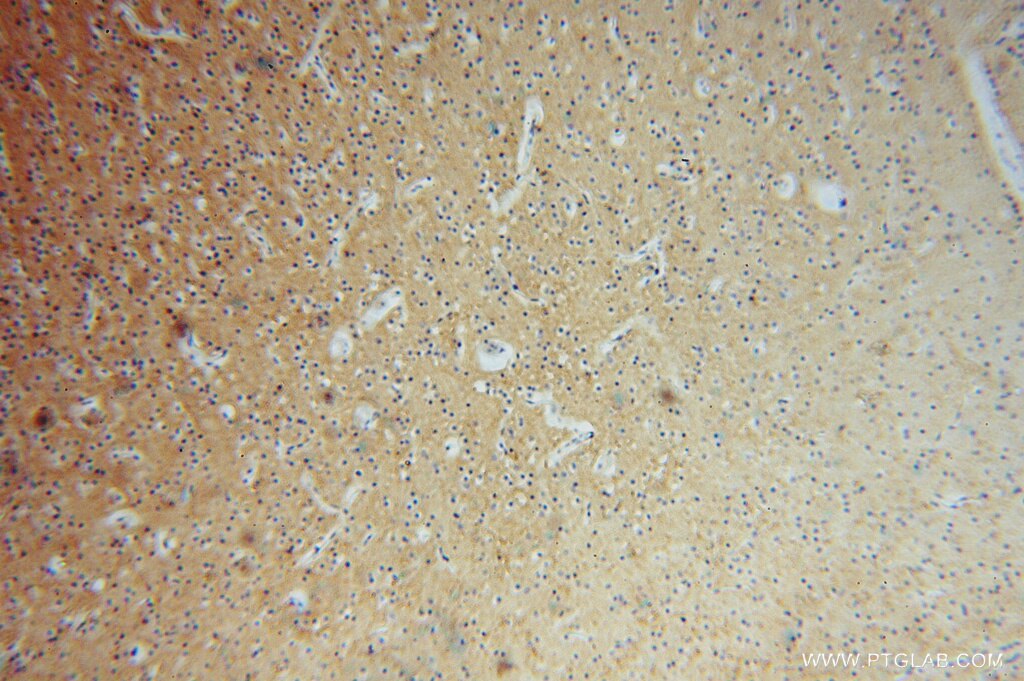 Immunohistochemistry (IHC) staining of human brain tissue using PCDHA5 Polyclonal antibody (15270-1-AP)