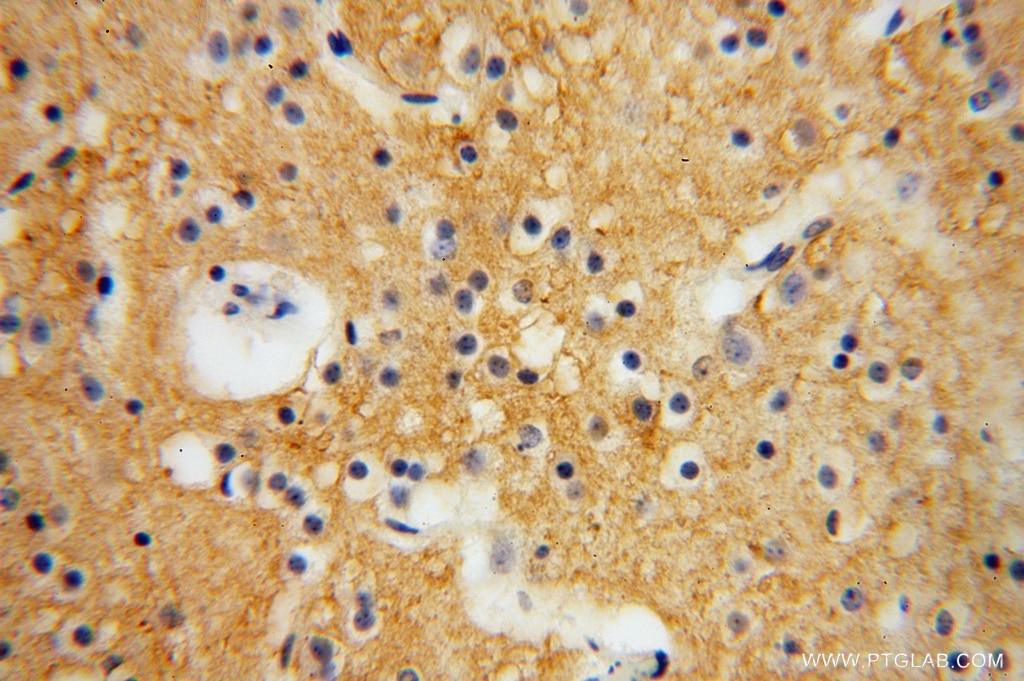 Immunohistochemistry (IHC) staining of human brain tissue using PCDHA5 Polyclonal antibody (15270-1-AP)