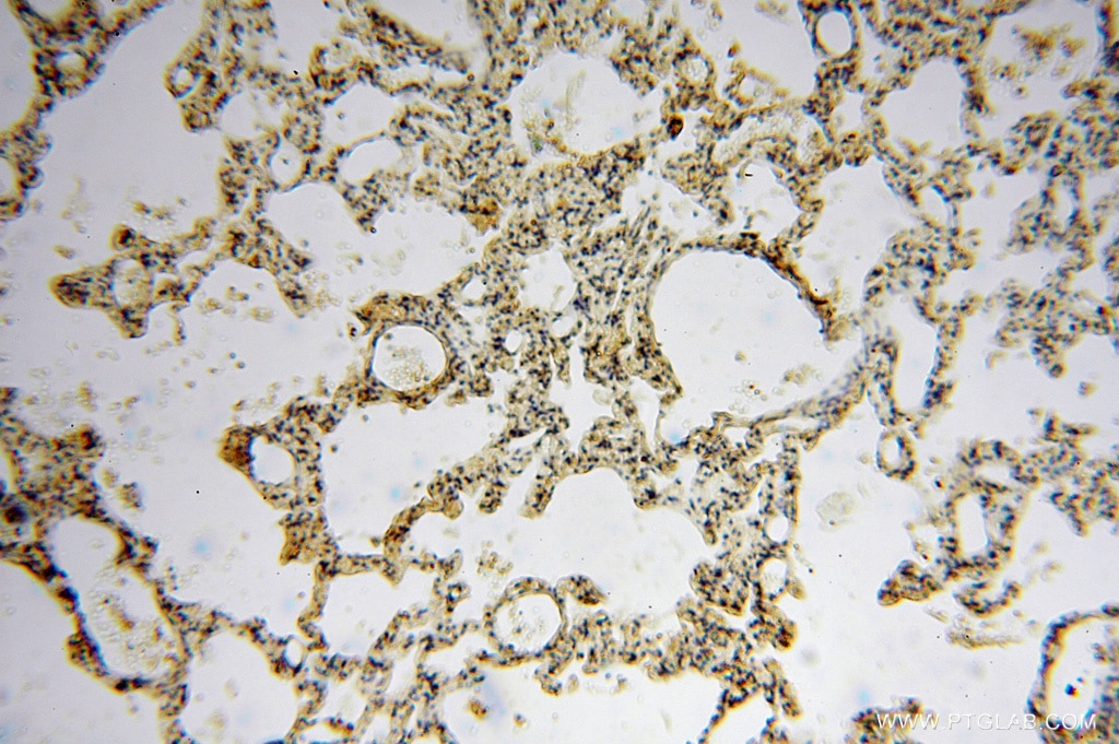 Immunohistochemistry (IHC) staining of human lung tissue using PCDHA5 Polyclonal antibody (15270-1-AP)