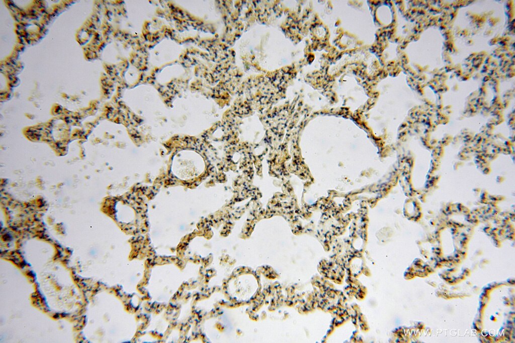 IHC staining of human lung using 15270-1-AP