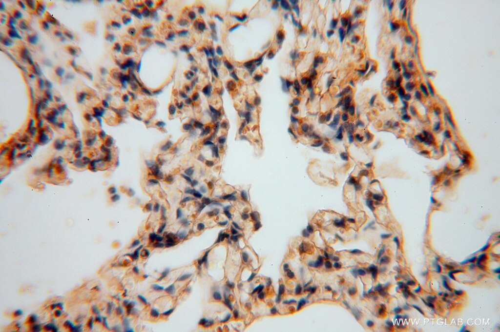 Immunohistochemistry (IHC) staining of human lung tissue using PCDHA5 Polyclonal antibody (15270-1-AP)