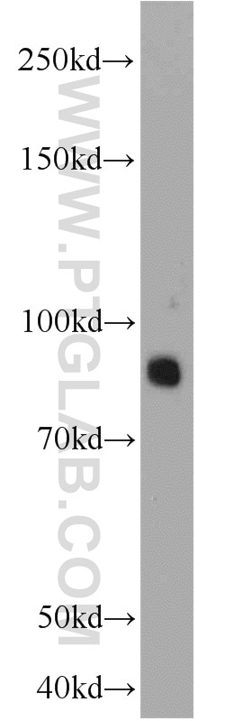 Western Blot (WB) analysis of mouse brain tissue using PCDHA5 Polyclonal antibody (15270-1-AP)