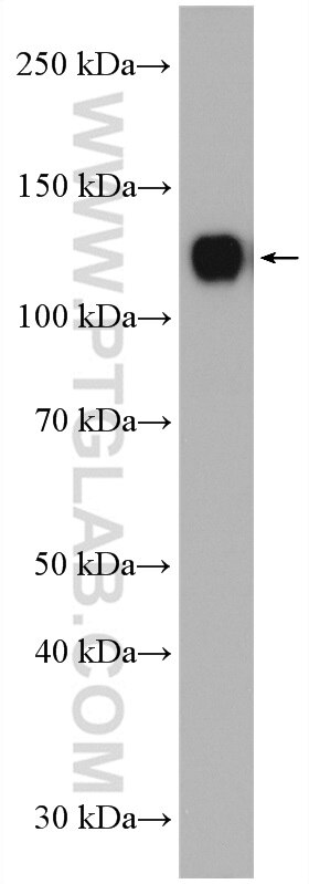 WB analysis of mouse brain using 12853-1-AP