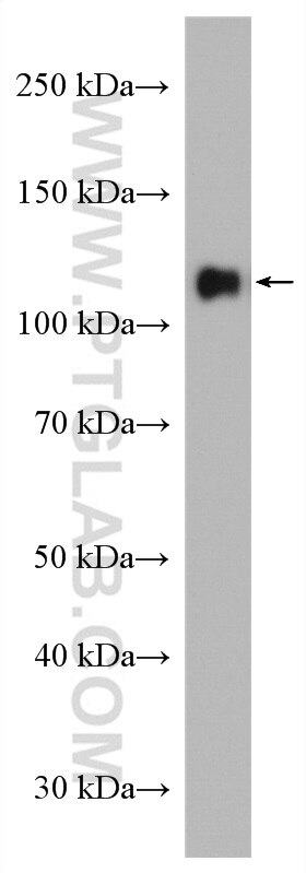 Western Blot (WB) analysis of rat brain tissue using PCDHA6 Polyclonal antibody (12853-1-AP)