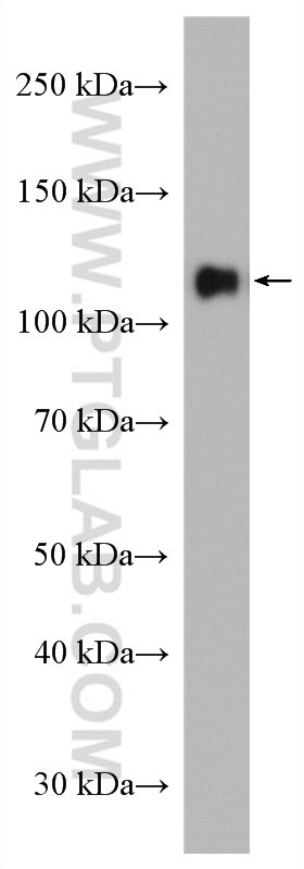 WB analysis of rat brain using 12853-1-AP