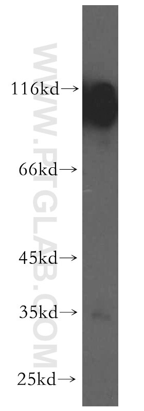 Western Blot (WB) analysis of human brain tissue using PCDHA6 Polyclonal antibody (12853-1-AP)