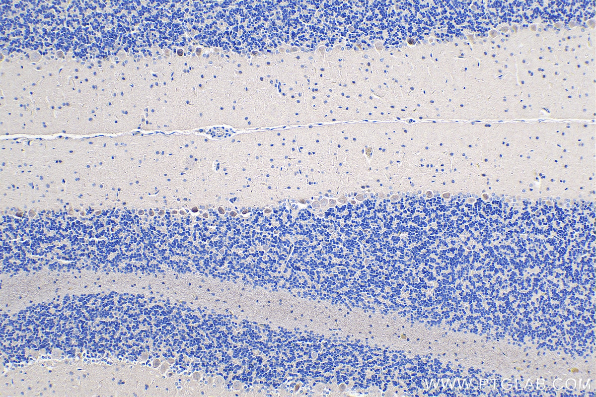 Immunohistochemistry (IHC) staining of rat cerebellum tissue using PCDHA9 Polyclonal antibody (18075-1-AP)