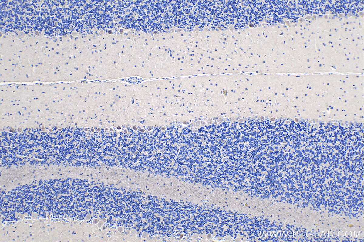 Immunohistochemistry (IHC) staining of rat cerebellum tissue using PCDHA9 Polyclonal antibody (18075-1-AP)