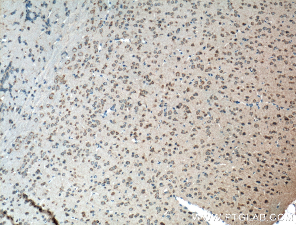Immunohistochemistry (IHC) staining of mouse brain tissue using PCDHA9 Polyclonal antibody (18075-1-AP)