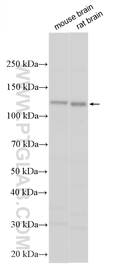 Various lysates were subjected to SDS PAGE followed by western blot with 18211-1-AP (PCDHAC2 antibody) at dilution of 1:1000 incubated at room temperature for 1.5 hours. Western Blot (WB) analysis of various lysates using PCDHAC2 Polyclonal antibody (18211-1-AP)