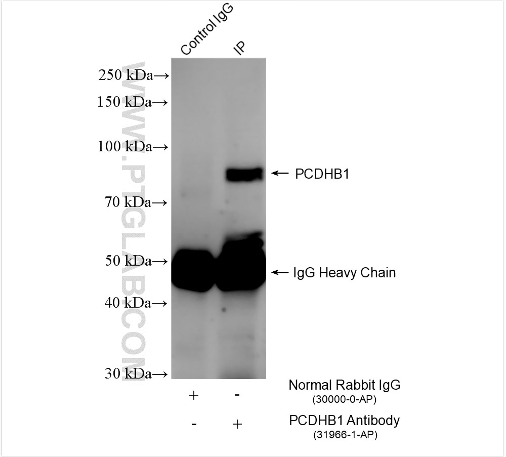 Immunoprecipitation (IP) experiment of mouse skeletal muscle tissue using PCDHB1 Polyclonal antibody (31966-1-AP)