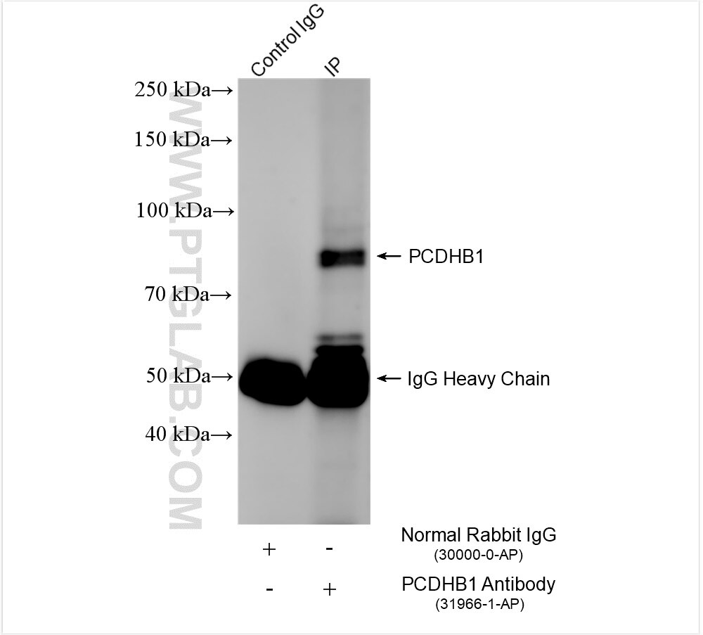 Immunoprecipitation (IP) experiment of rat skeletal muscle tissue using PCDHB1 Polyclonal antibody (31966-1-AP)