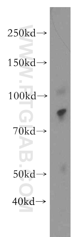 PCDHB10