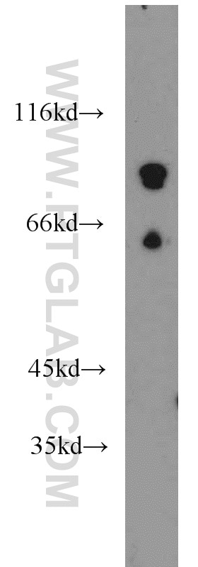 Western Blot (WB) analysis of mouse brain tissue using PCDHB12 Polyclonal antibody (14020-1-AP)