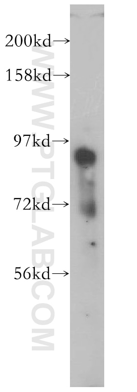 Western Blot (WB) analysis of mouse brain tissue using PCDHB12 Polyclonal antibody (14020-1-AP)