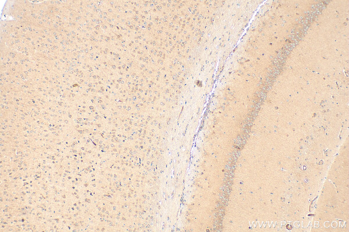 Immunohistochemistry (IHC) staining of mouse brain tissue using PCDHB13 Polyclonal antibody (17050-1-AP)