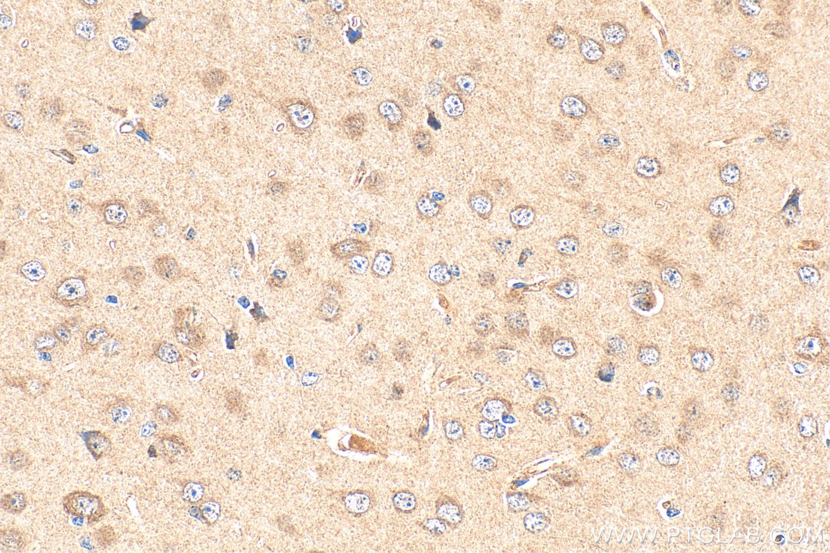 Immunohistochemistry (IHC) staining of mouse brain tissue using PCDHB13 Polyclonal antibody (17050-1-AP)
