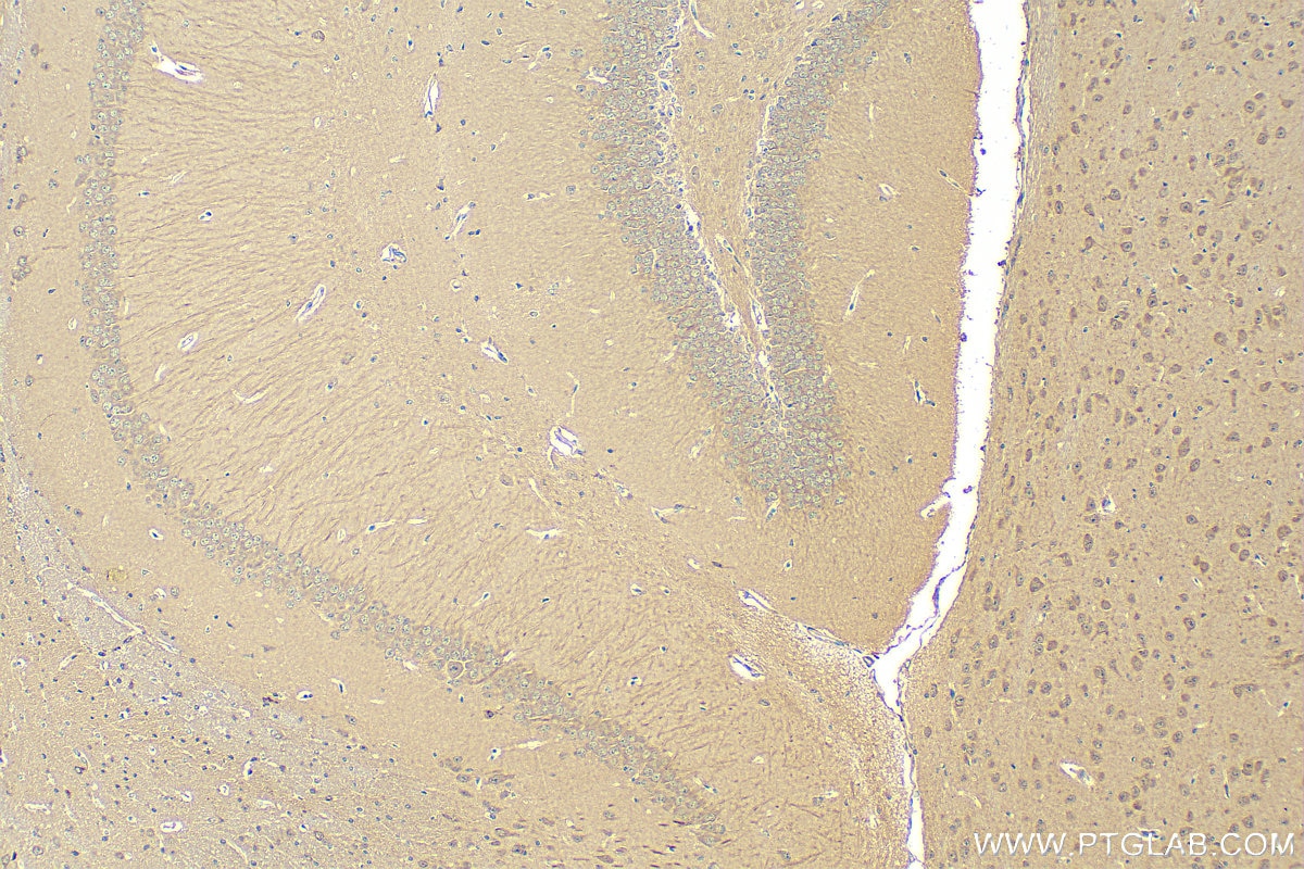 Immunohistochemistry (IHC) staining of mouse brain tissue using PCDHB15 Polyclonal antibody (13583-1-AP)