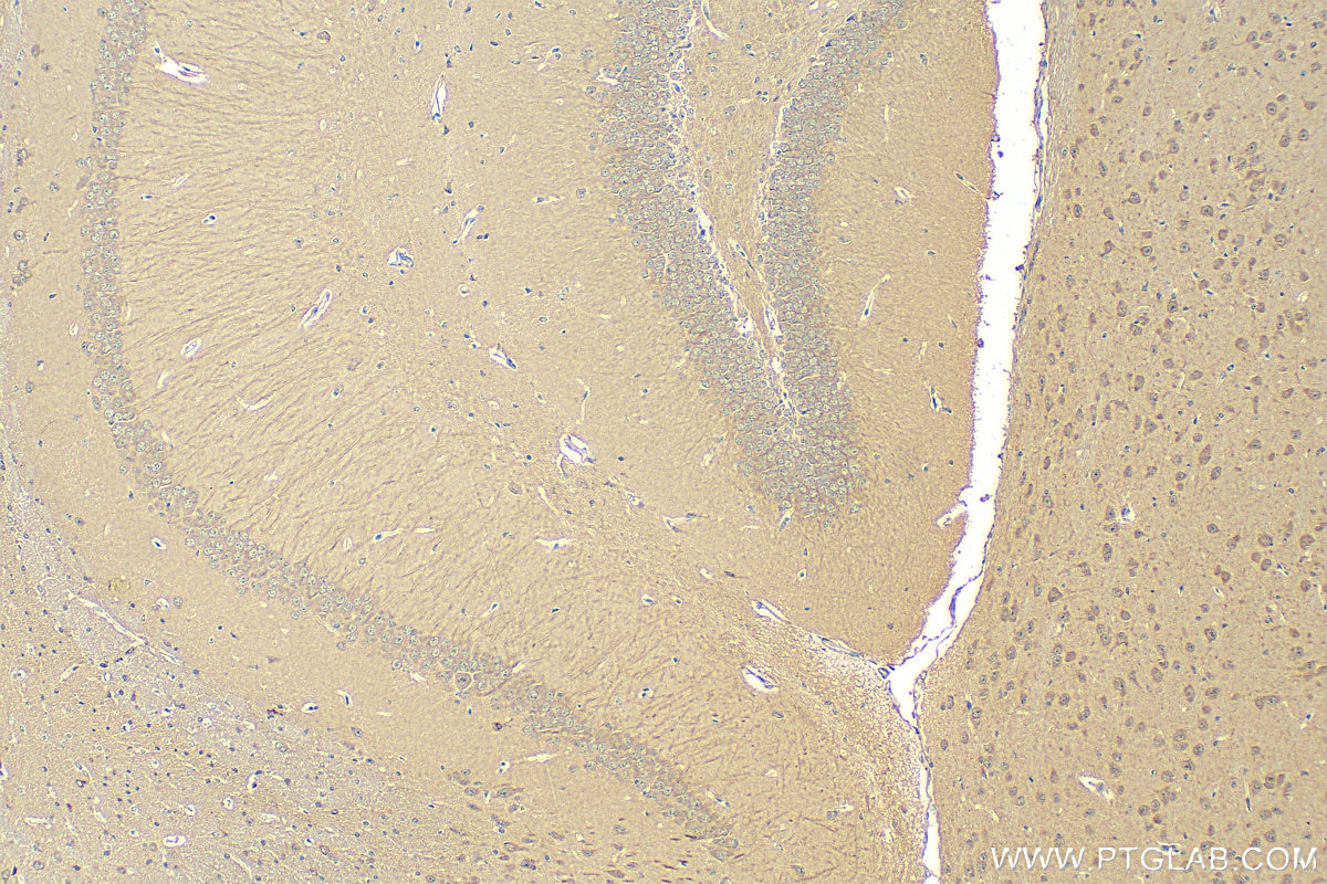 Immunohistochemistry (IHC) staining of mouse brain tissue using PCDHB15 Polyclonal antibody (13583-1-AP)