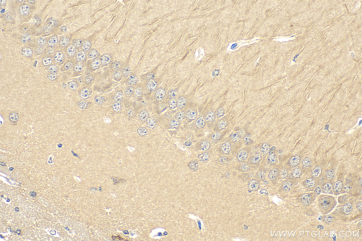 IHC staining of mouse brain using 13583-1-AP