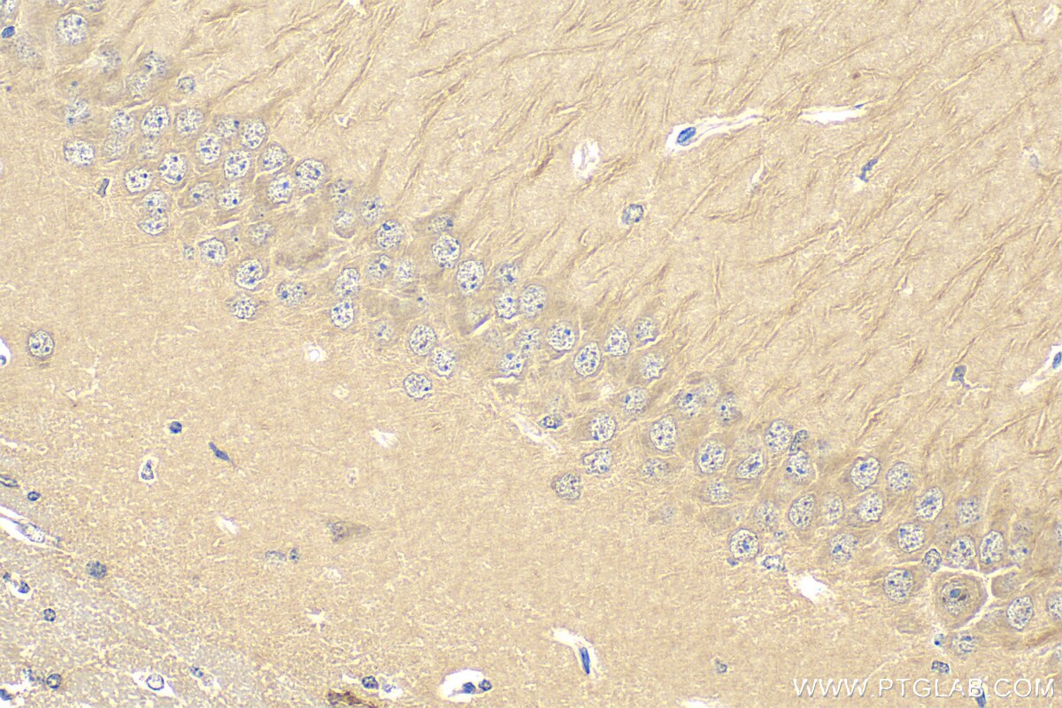 Immunohistochemistry (IHC) staining of mouse brain tissue using PCDHB15 Polyclonal antibody (13583-1-AP)