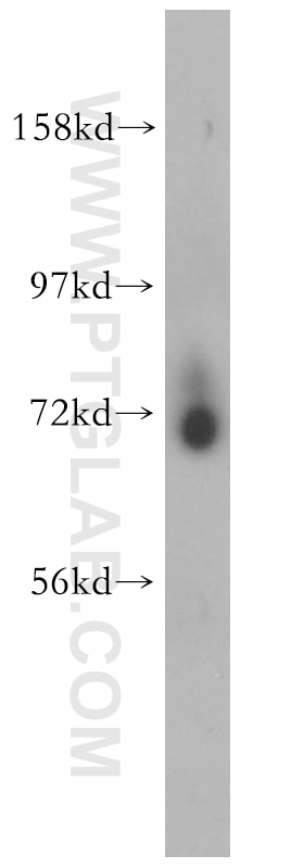 Western Blot (WB) analysis of HepG2 cells using PCDHB5 Polyclonal antibody (15245-1-AP)