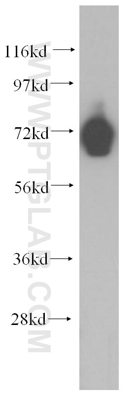 Western Blot (WB) analysis of K-562 cells using PCDHB5 Polyclonal antibody (15245-1-AP)