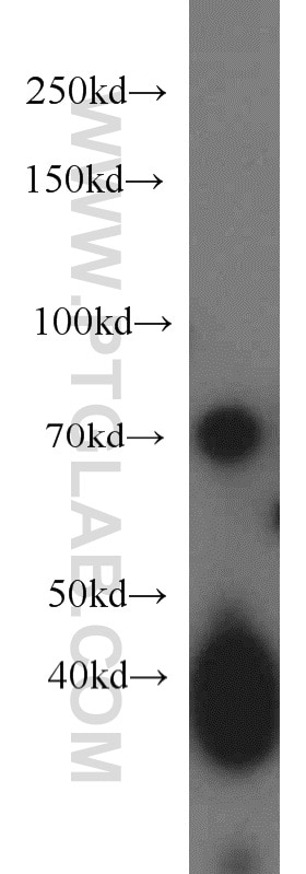 Western Blot (WB) analysis of mouse brain tissue using PCDHB5 Polyclonal antibody (19609-1-AP)