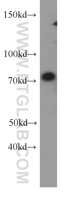Western Blot (WB) analysis of mouse liver tissue using PCDHB5 Polyclonal antibody (19609-1-AP)
