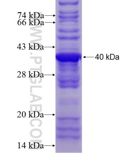 PCDHB5 fusion protein Ag7491 SDS-PAGE
