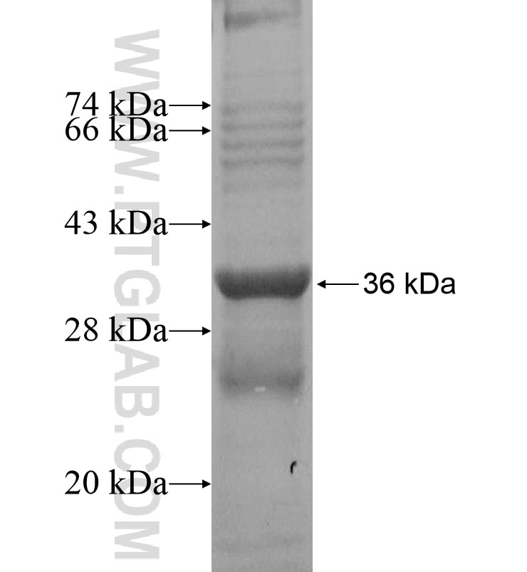 PCDHGA6 fusion protein Ag16198 SDS-PAGE PCDHGA6 fusion protein Ag16198 SDS-PAGE