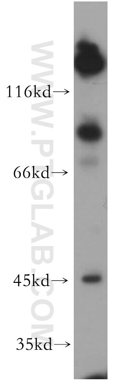 Western Blot (WB) analysis of Neuro-2a cells using PCDHGB3 Polyclonal antibody (21204-1-AP)