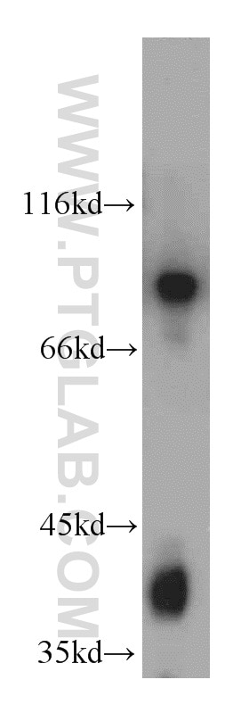 Western Blot (WB) analysis of human brain tissue using PCDHGB3 Polyclonal antibody (21204-1-AP)