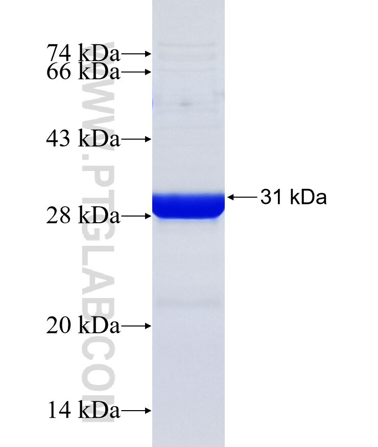 PCDHGB6 fusion protein Ag20314 SDS-PAGE