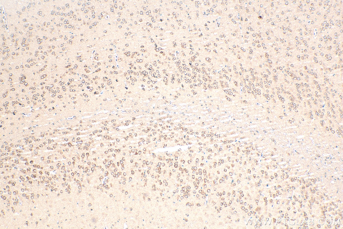 Immunohistochemistry (IHC) staining of mouse brain tissue using PCDHGC3 Polyclonal antibody (10857-1-AP)