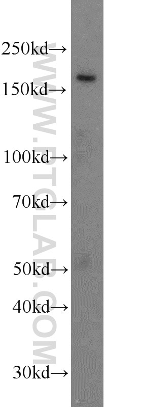 Western Blot (WB) analysis of HeLa cells using PCF11 Polyclonal antibody (23540-1-AP)