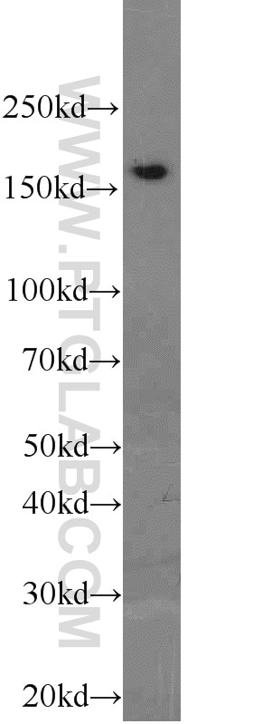 Western Blot (WB) analysis of K-562 cells using PCF11 Polyclonal antibody (23540-1-AP)