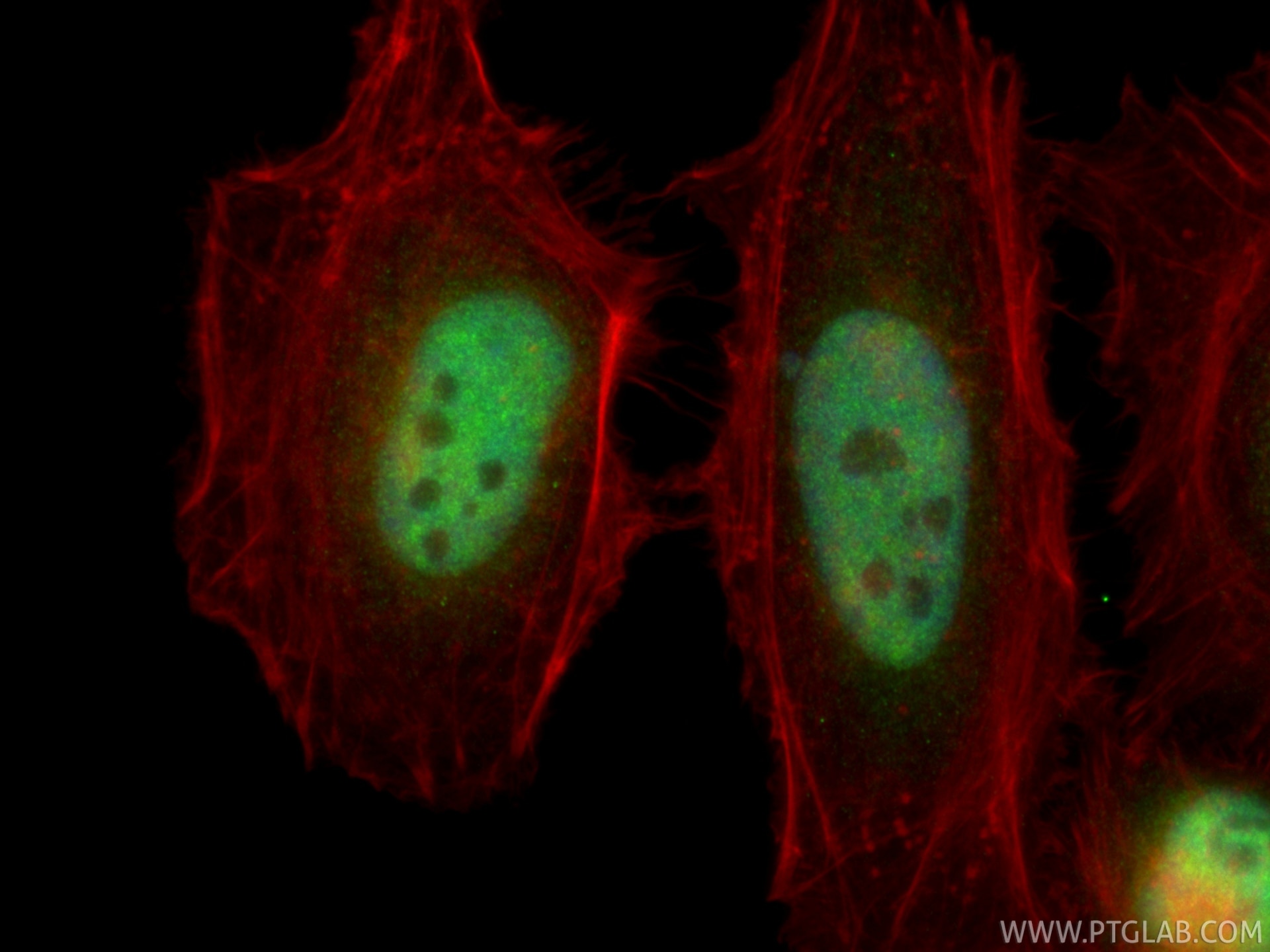 Immunofluorescence (IF) / fluorescent staining of HeLa cells using PCGF1 Polyclonal antibody (15581-1-AP)