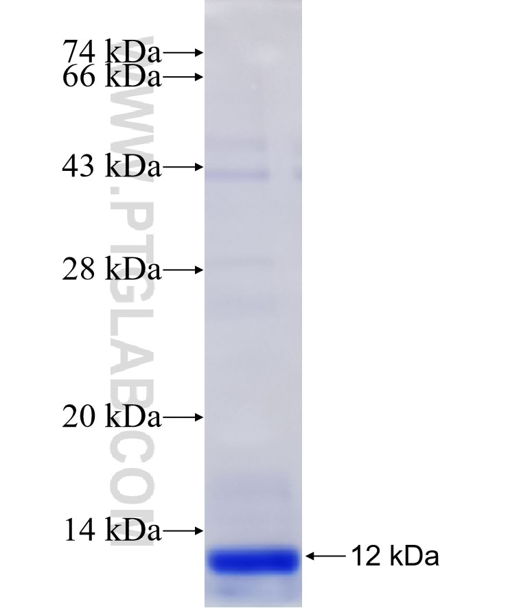 PCGF5 fusion protein Ag29476 SDS-PAGE PCGF5 fusion protein Ag29476 SDS-PAGE