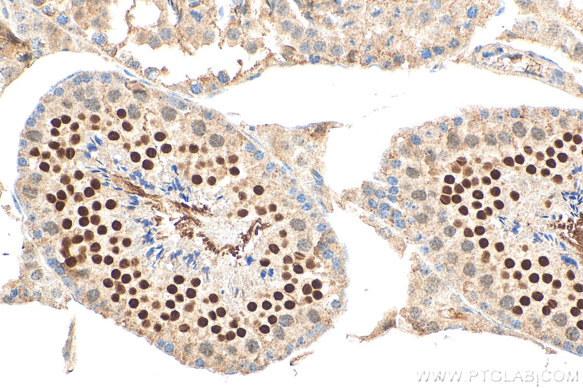 IHC staining of mouse testis using 24103-1-AP