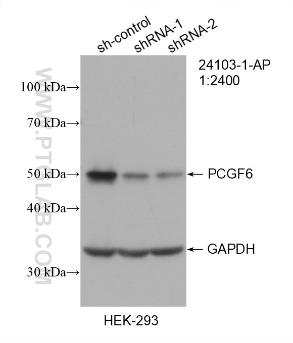 Western Blot (WB) analysis of HEK-293 cells using PCGF6 Polyclonal antibody (24103-1-AP)