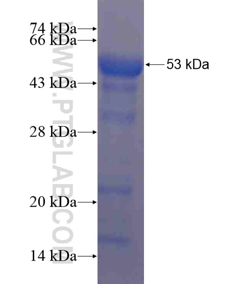 PCGF6 fusion protein Ag21124 SDS-PAGE