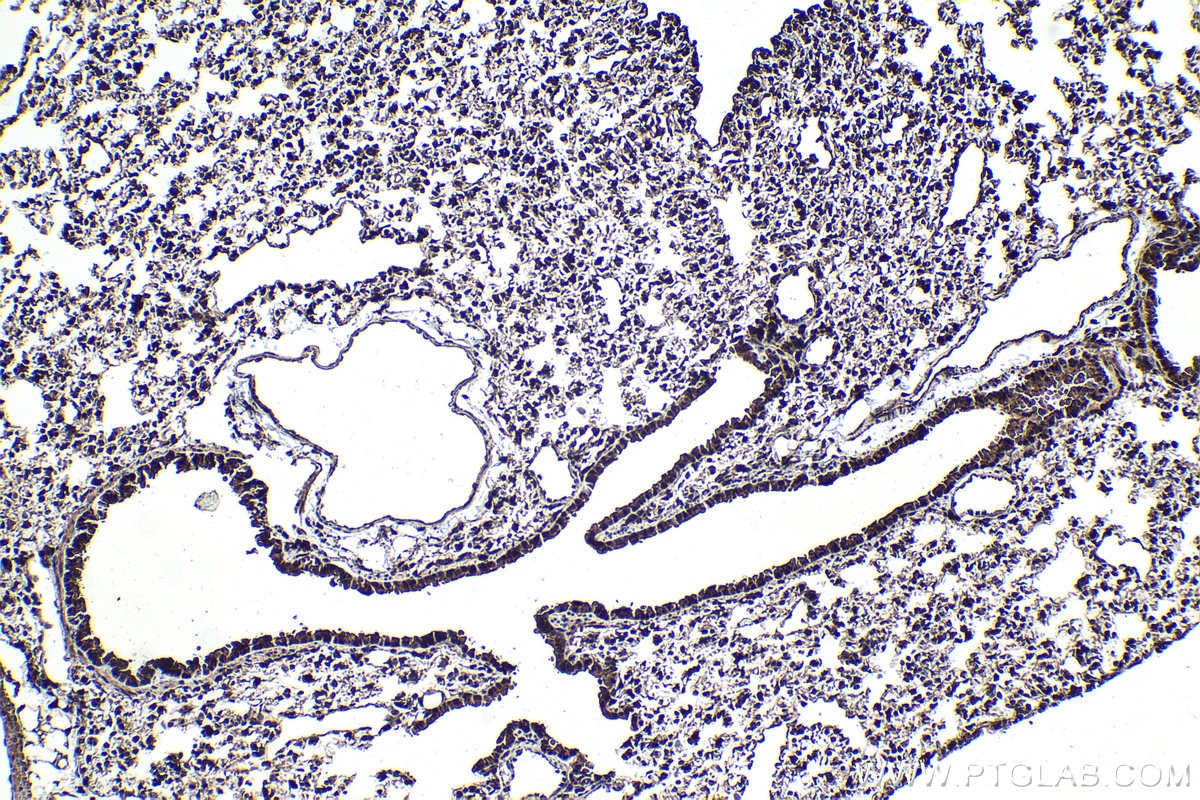 IHC staining of mouse lung using 26638-1-AP (same clone as 26638-1-PBS) Immunohistochemistry (IHC) staining of mouse lung tissue using PCID2 Polyclonal antibody (26638-1-AP)