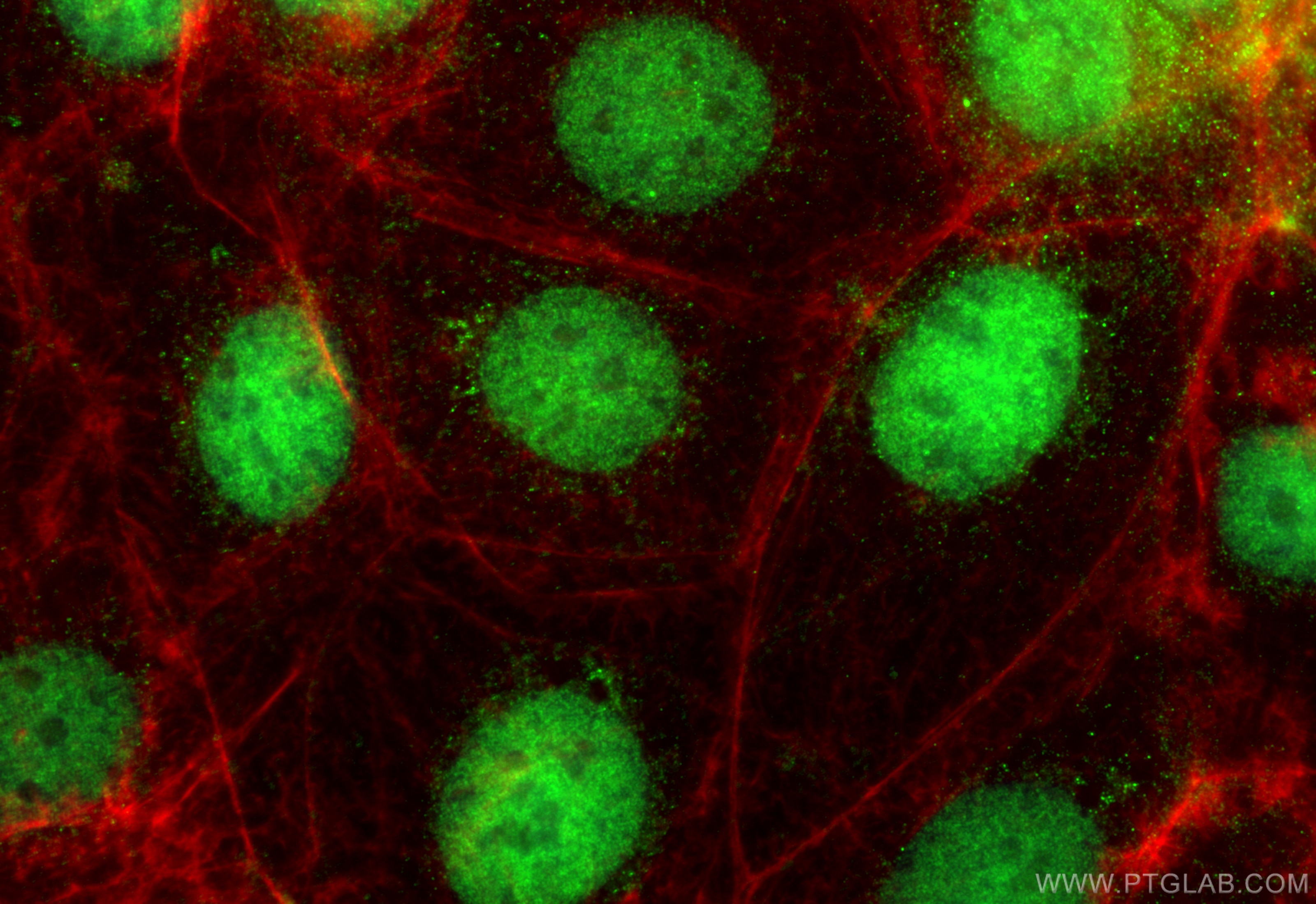 Immunofluorescence (IF) / fluorescent staining of Caco-2 cells using PCIF1 Polyclonal antibody (16082-1-AP)