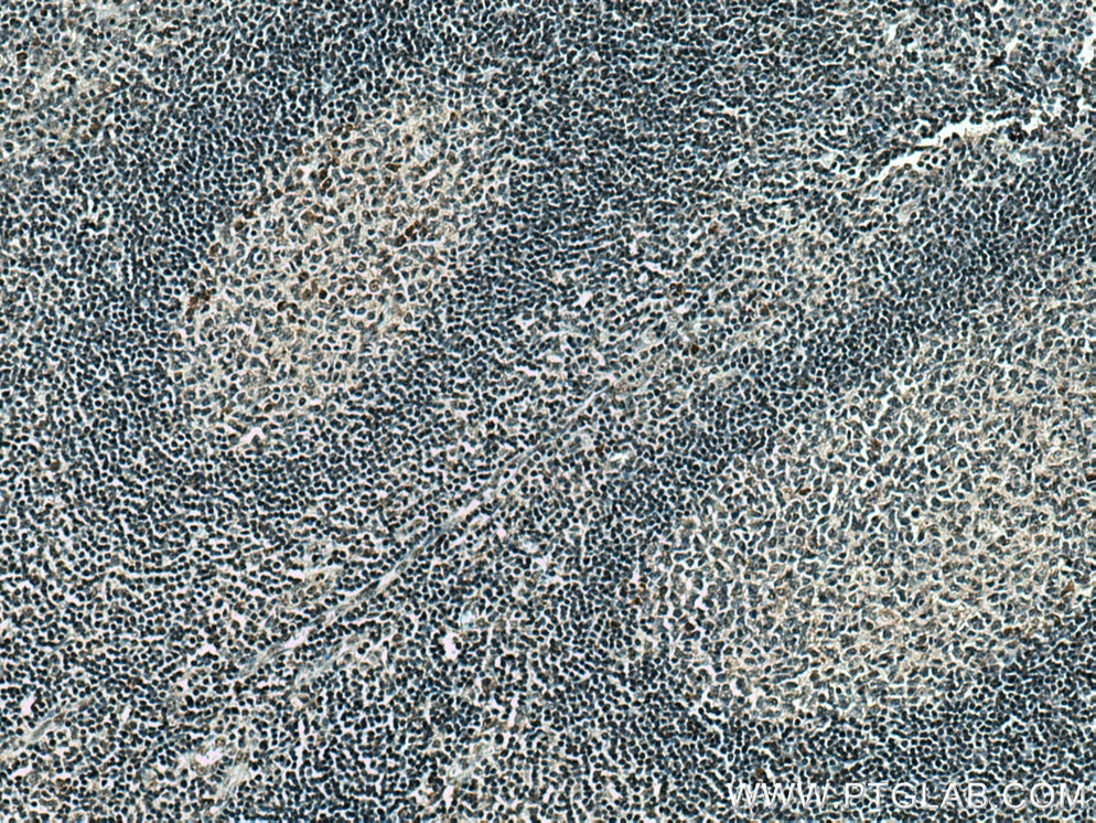 Immunohistochemistry (IHC) staining of human tonsillitis tissue using PCIF1 Polyclonal antibody (16082-1-AP)