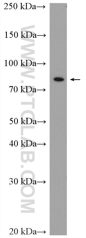 Western Blot (WB) analysis of HEK-293T cells using PCIF1 Polyclonal antibody (16082-1-AP)